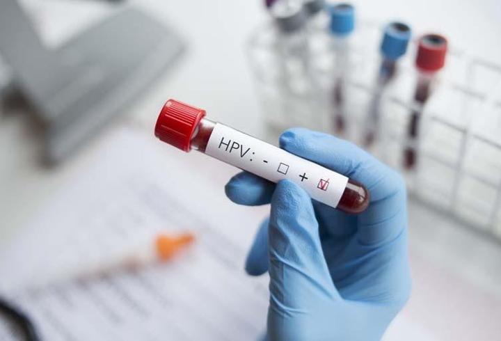 Uzmanı açıkladı: ‘HPV pozitifliği doğrudan kanser anlamına gelmez’